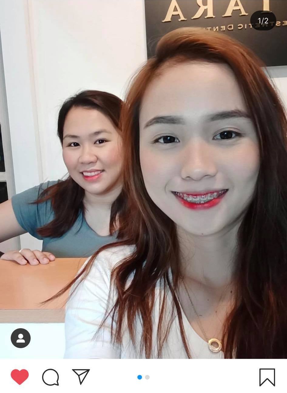 Patient selfie with braces at Tiara Dental Clinic in Cubao under the gold Tiara signage